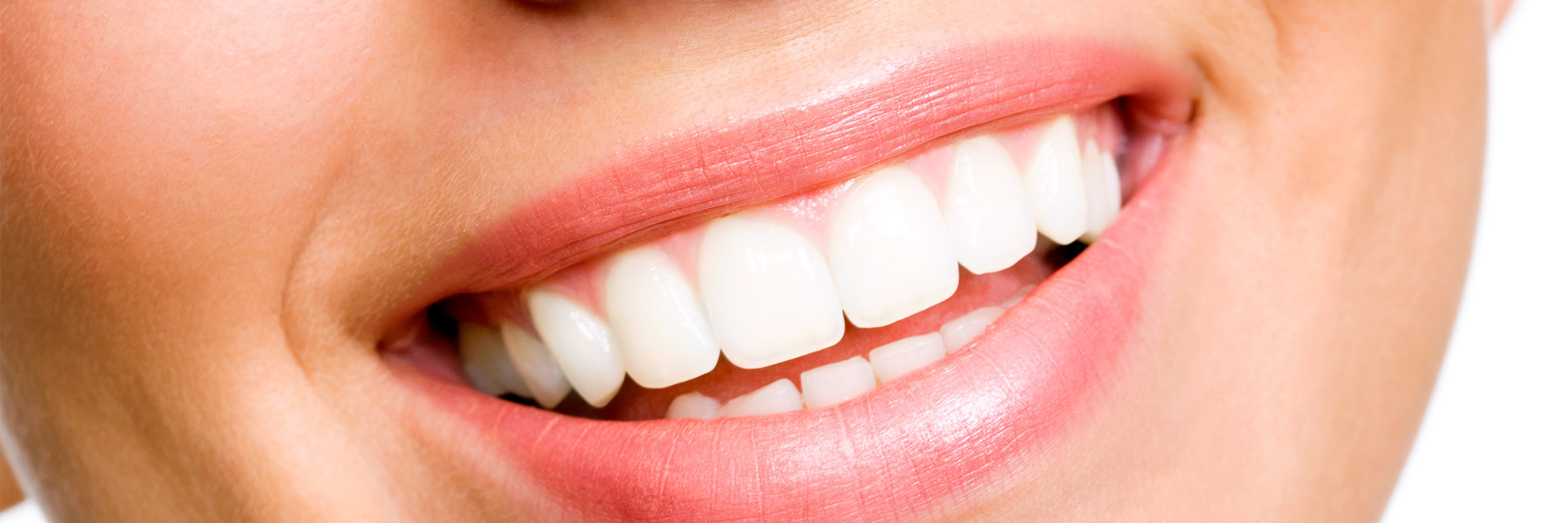 Woman with a big smile with white teeth showing off for her dentist in Idaho Falls, Dr. Michael Elison.