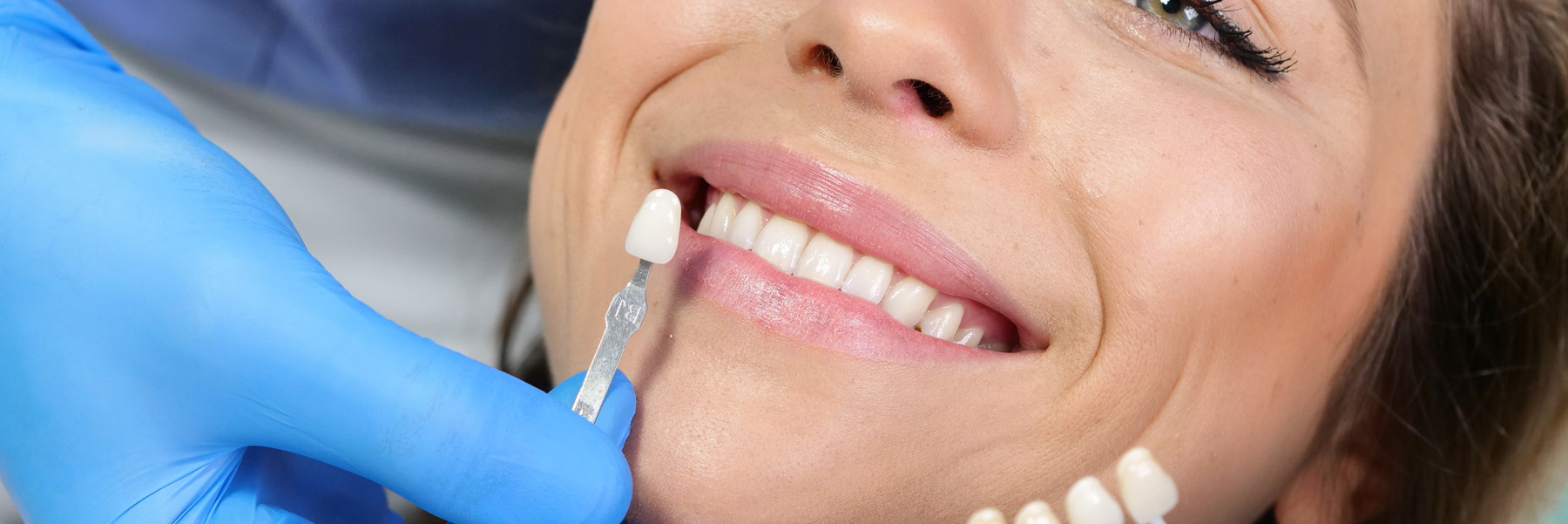 Woman matching color of a dental crown from her dentist in Idaho Falls, Dr. Michael Elison.